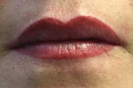 lips