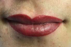 lips