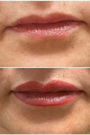 lips