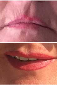 lips
