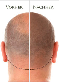 Scalp
